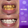 Image of Purple Teeth Whitening Gel