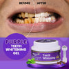 Image of Purple Teeth Whitening Gel